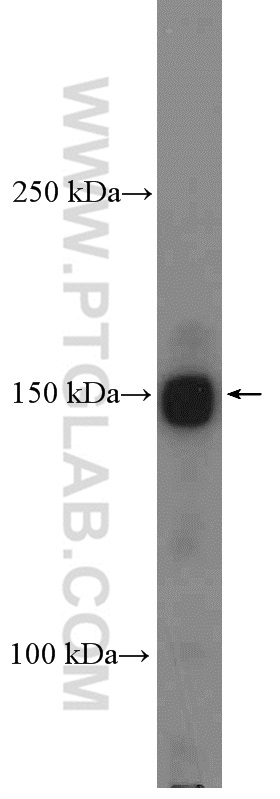Intersectin 1 Polyclonal antibody