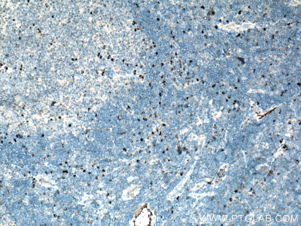 IL-6 Polyclonal antibody
