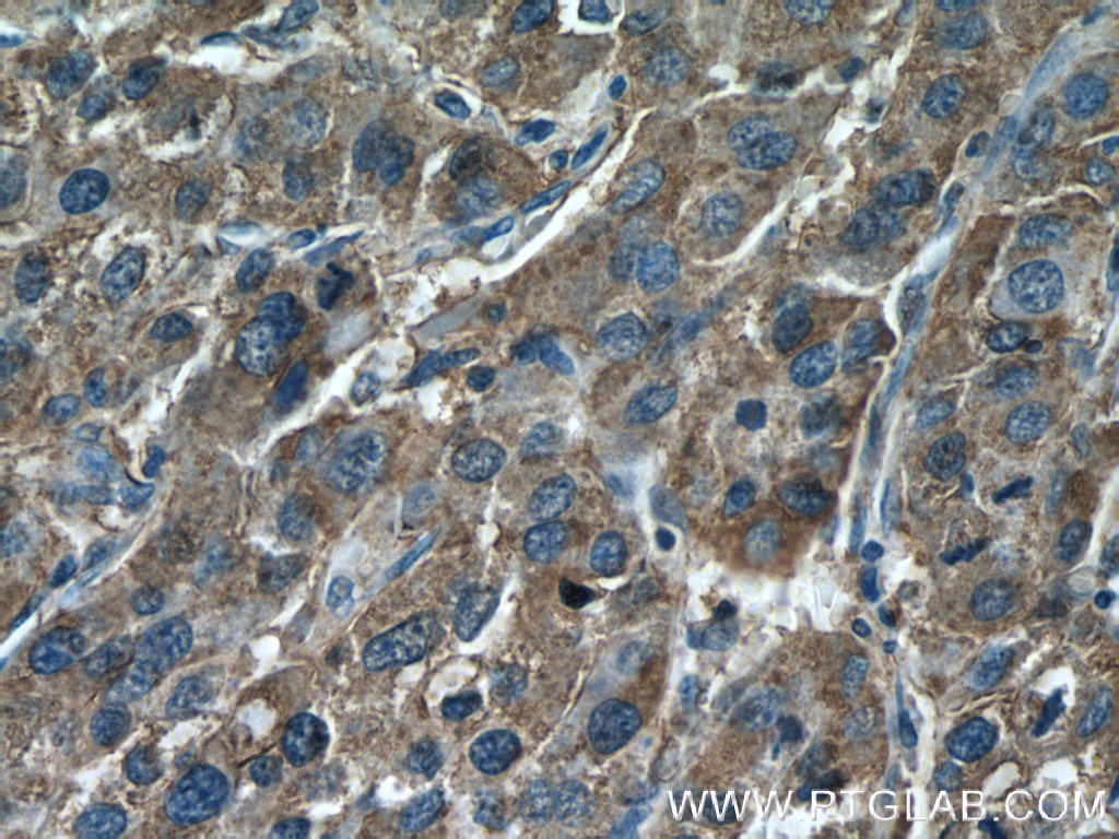DUS4L Polyclonal antibody