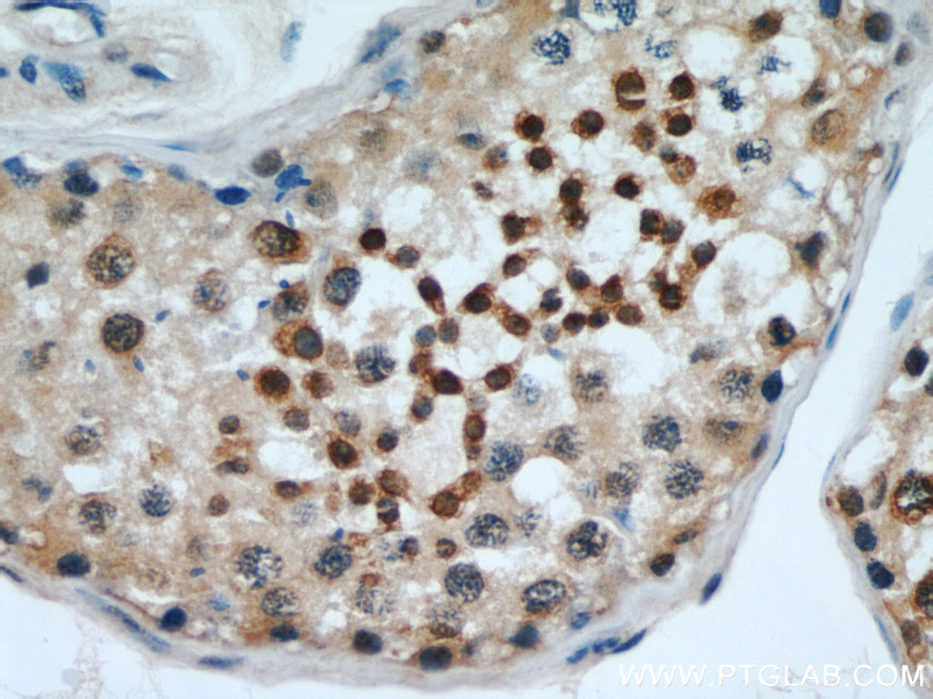 EDRF1 Polyclonal antibody