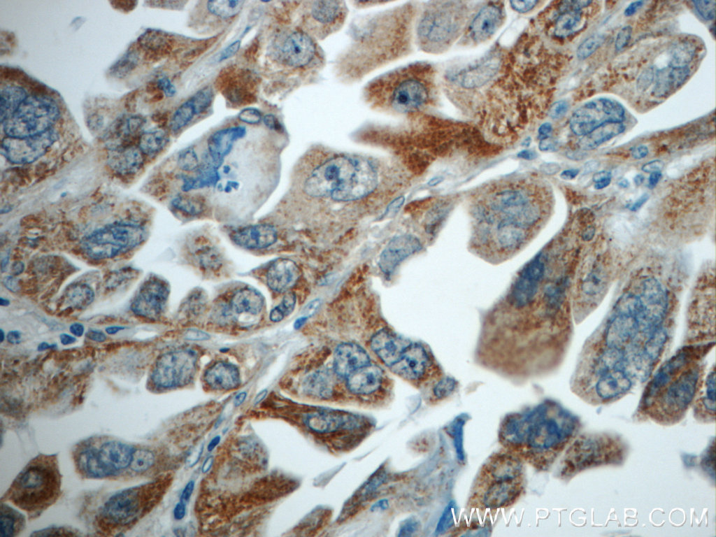 TMEM139 Polyclonal antibody