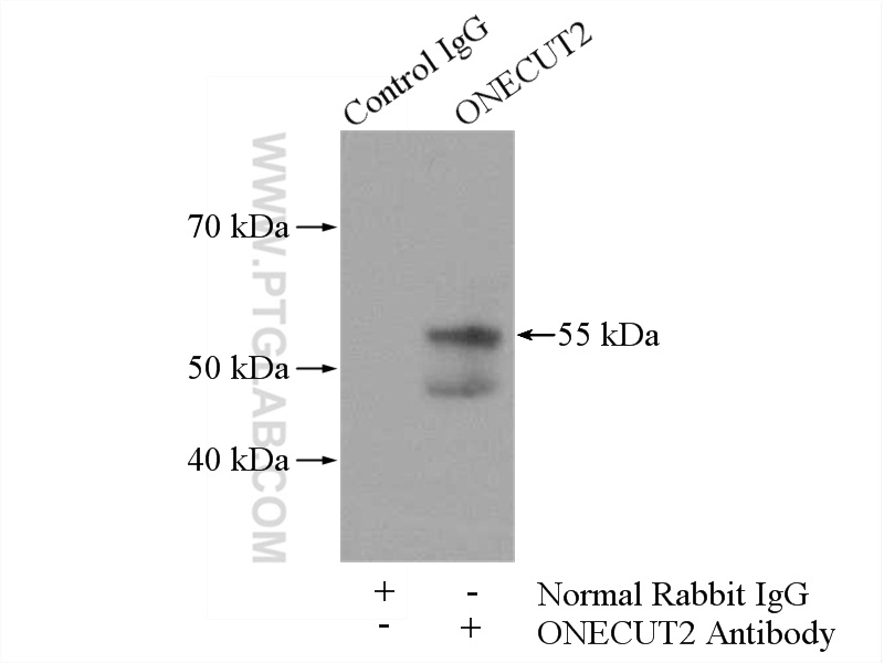 ONECUT2 Polyclonal antibody