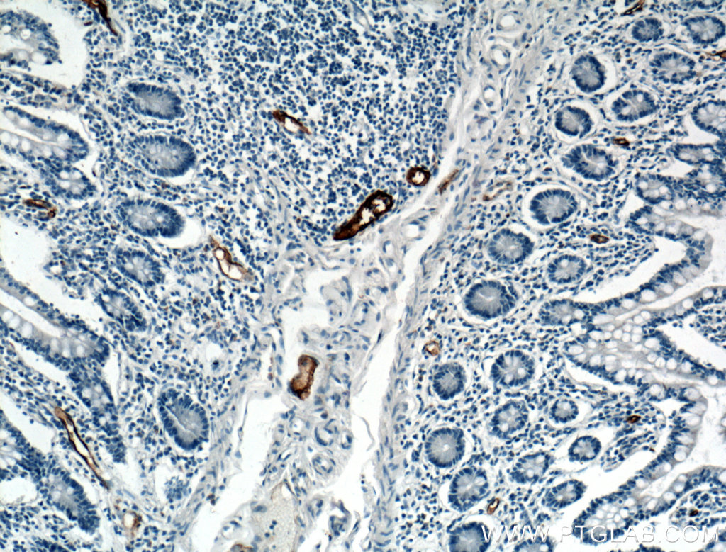 MAdCAM1 Polyclonal antibody