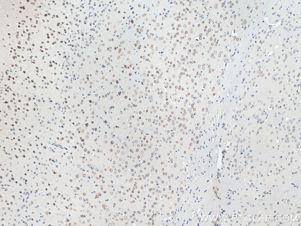 VMA21 Polyclonal antibody