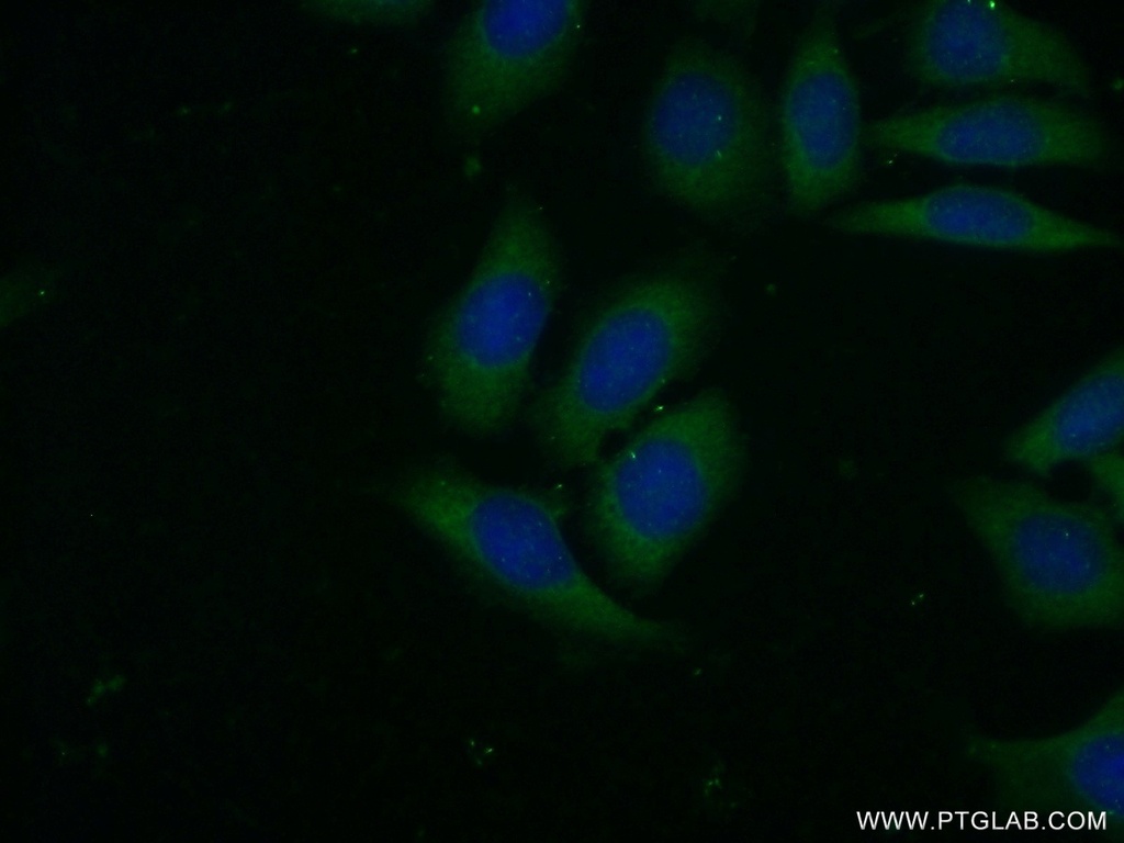 VAV2 Polyclonal antibody