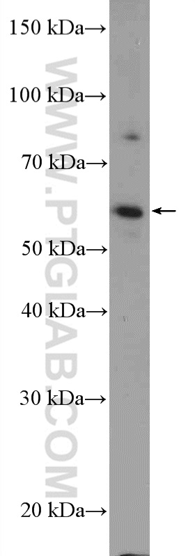 KIAA0895 Polyclonal antibody