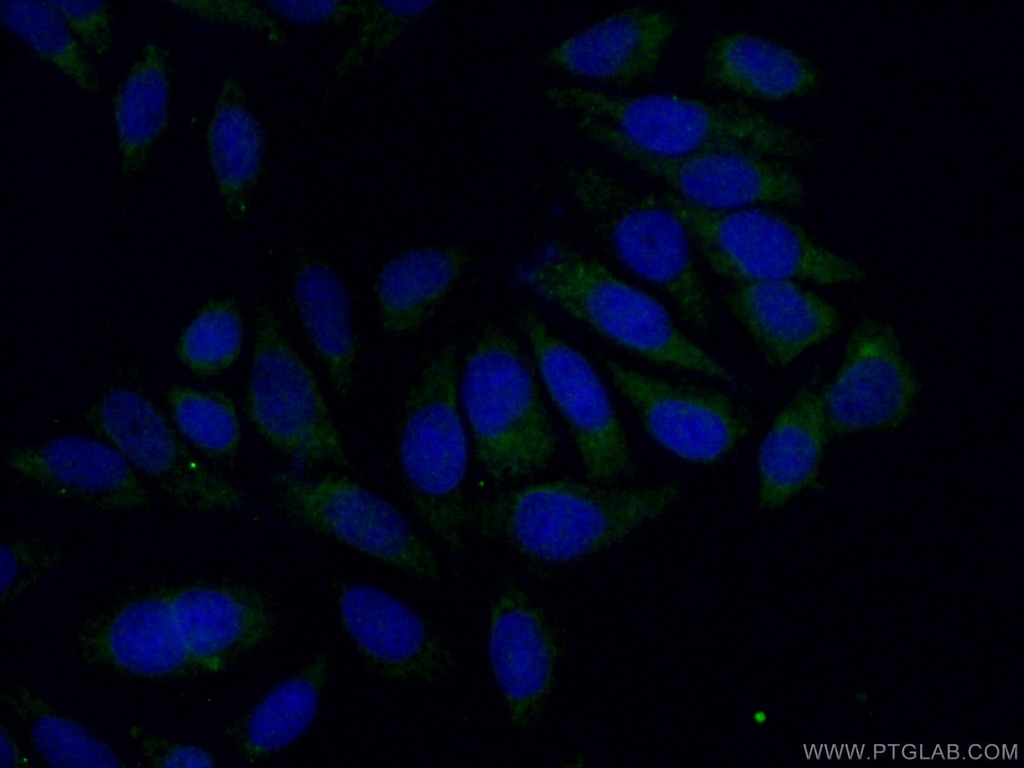 Sclerostin Polyclonal antibody