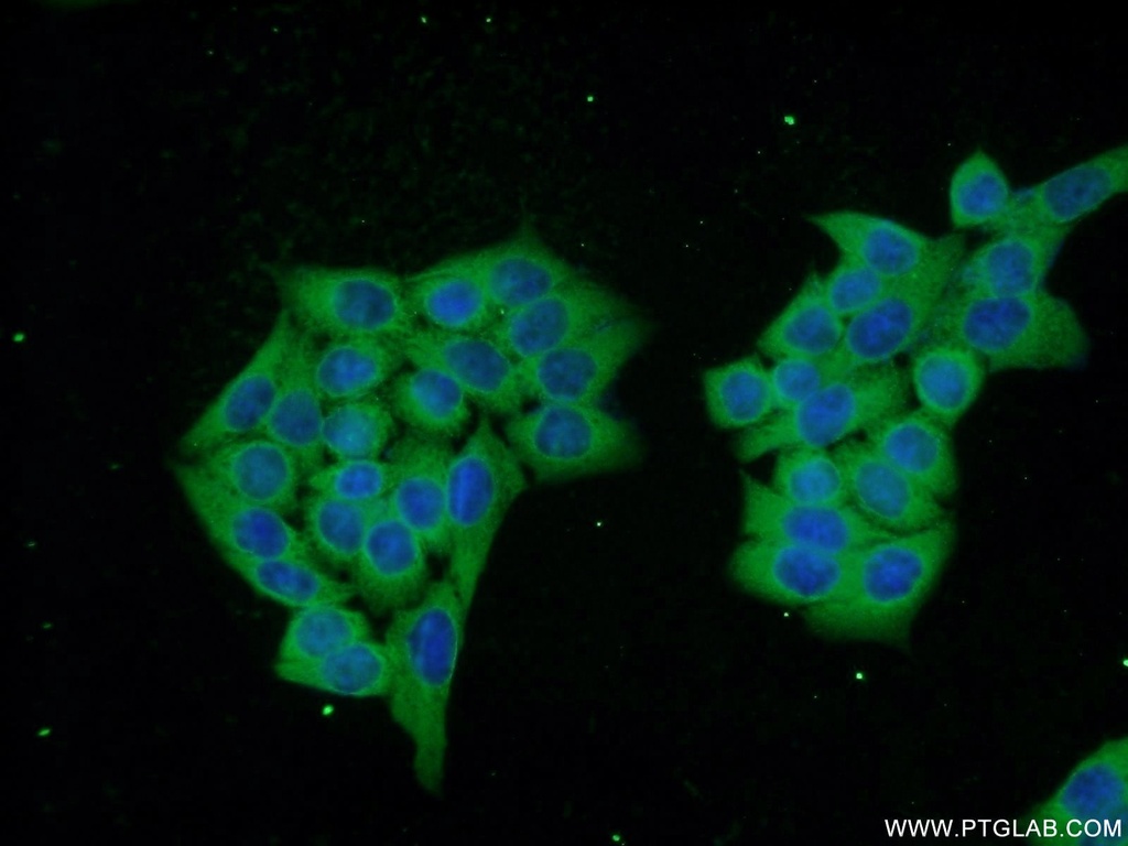 DNAJC6/AUXILIN Polyclonal antibody