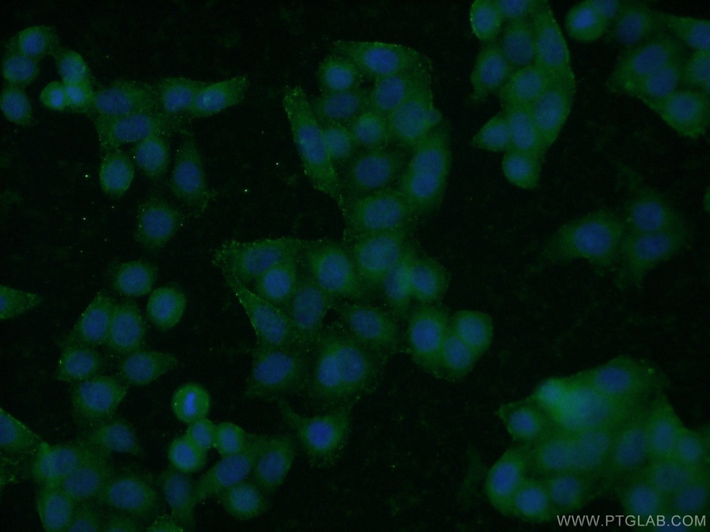 ROM1 Polyclonal antibody