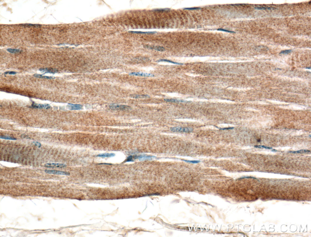 TSPAN31 Polyclonal antibody