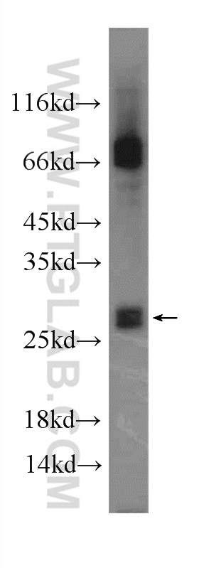 MYCT1 Polyclonal antibody