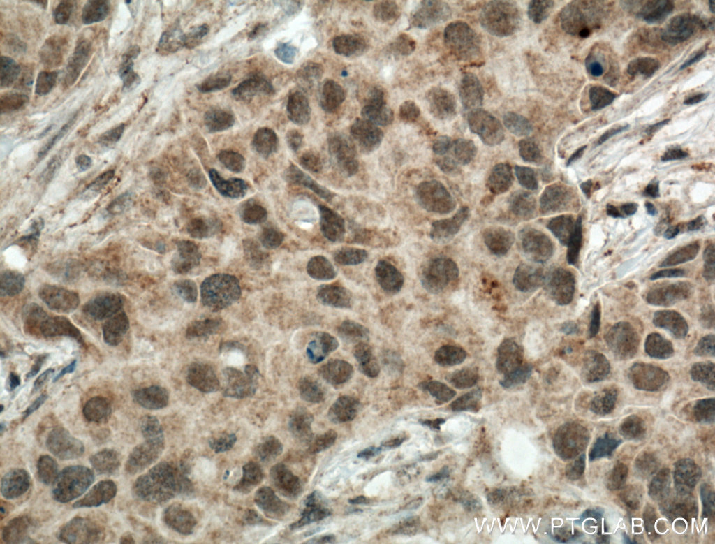TBP Polyclonal antibody