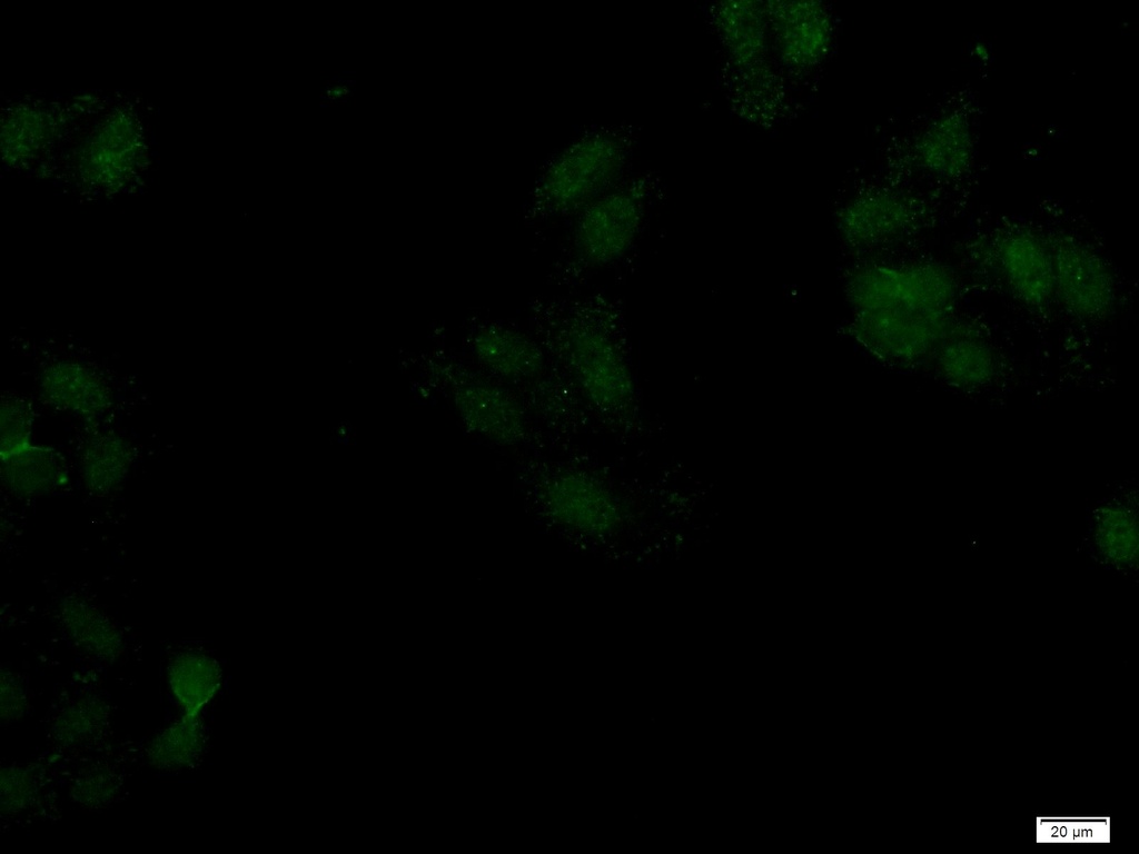 SAMD14 Polyclonal antibody