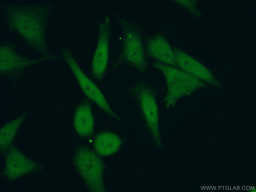 PHF20 Polyclonal antibody