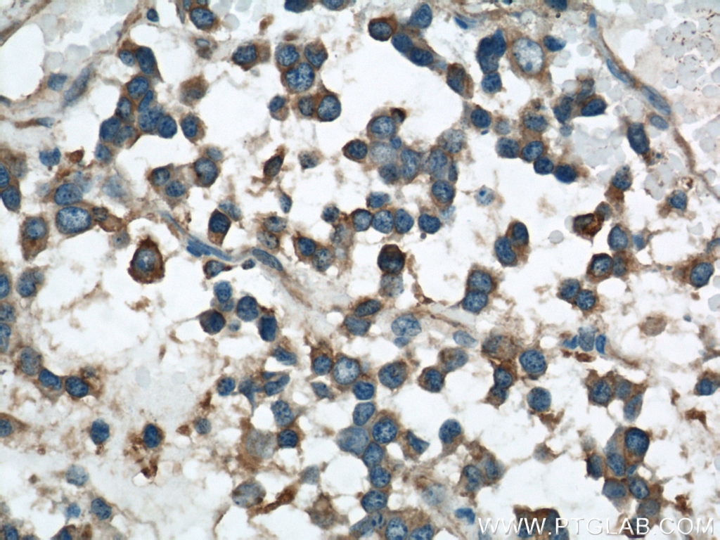 VAT1 Polyclonal antibody