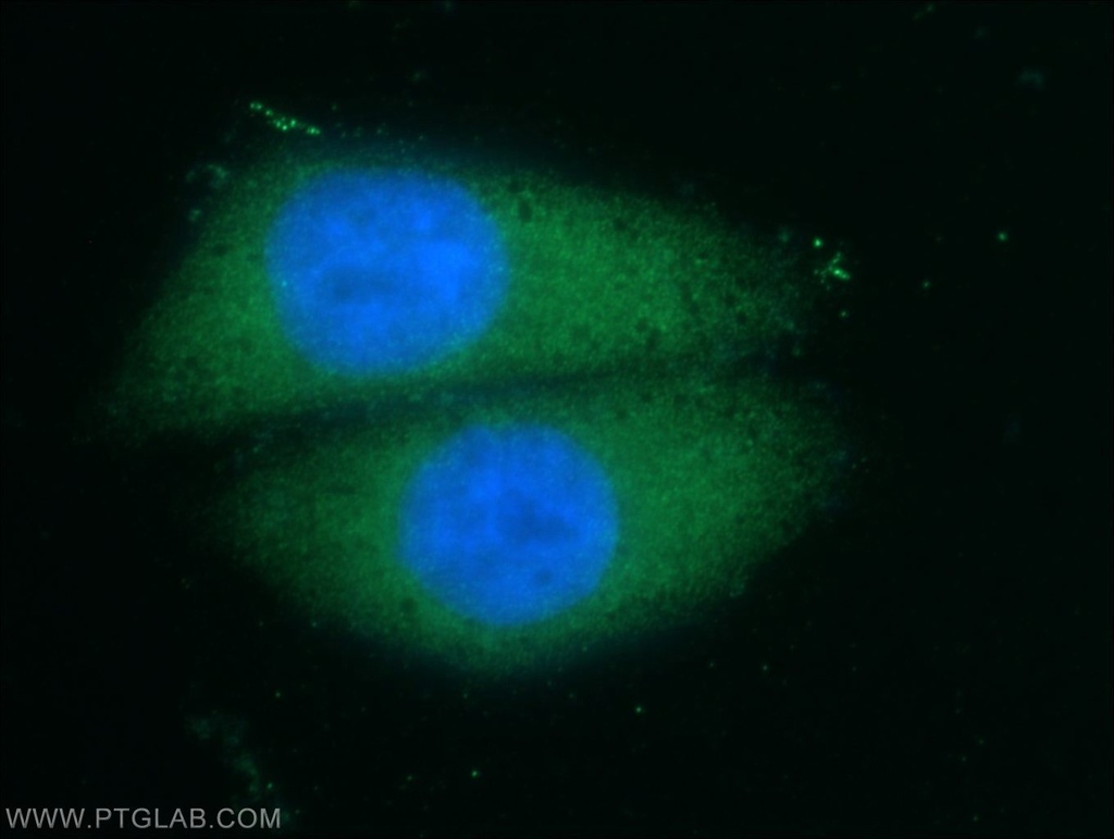 NFATC2 Polyclonal antibody