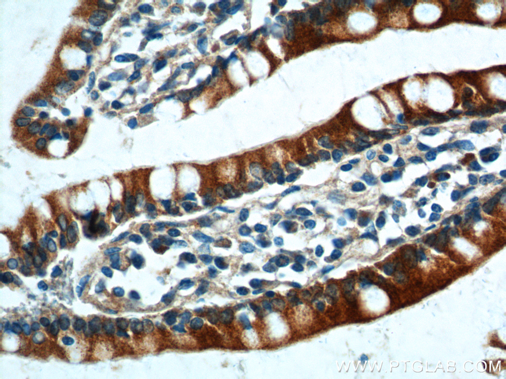 PIGR Polyclonal antibody