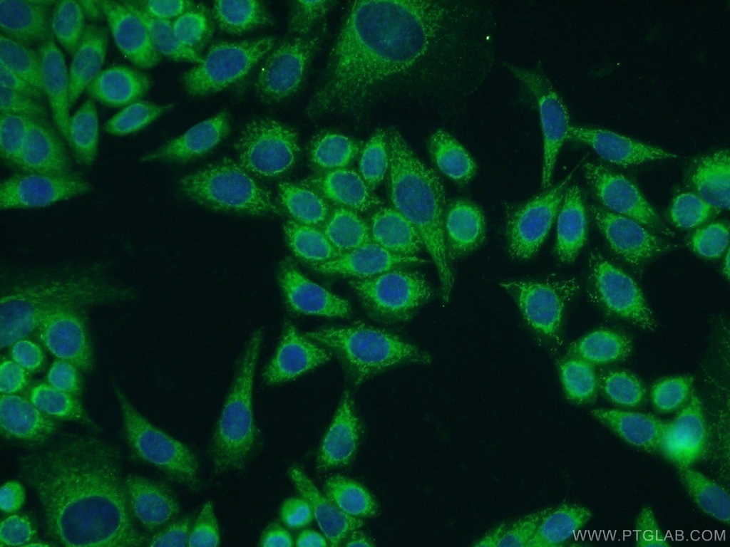 PIK3C2A Polyclonal antibody