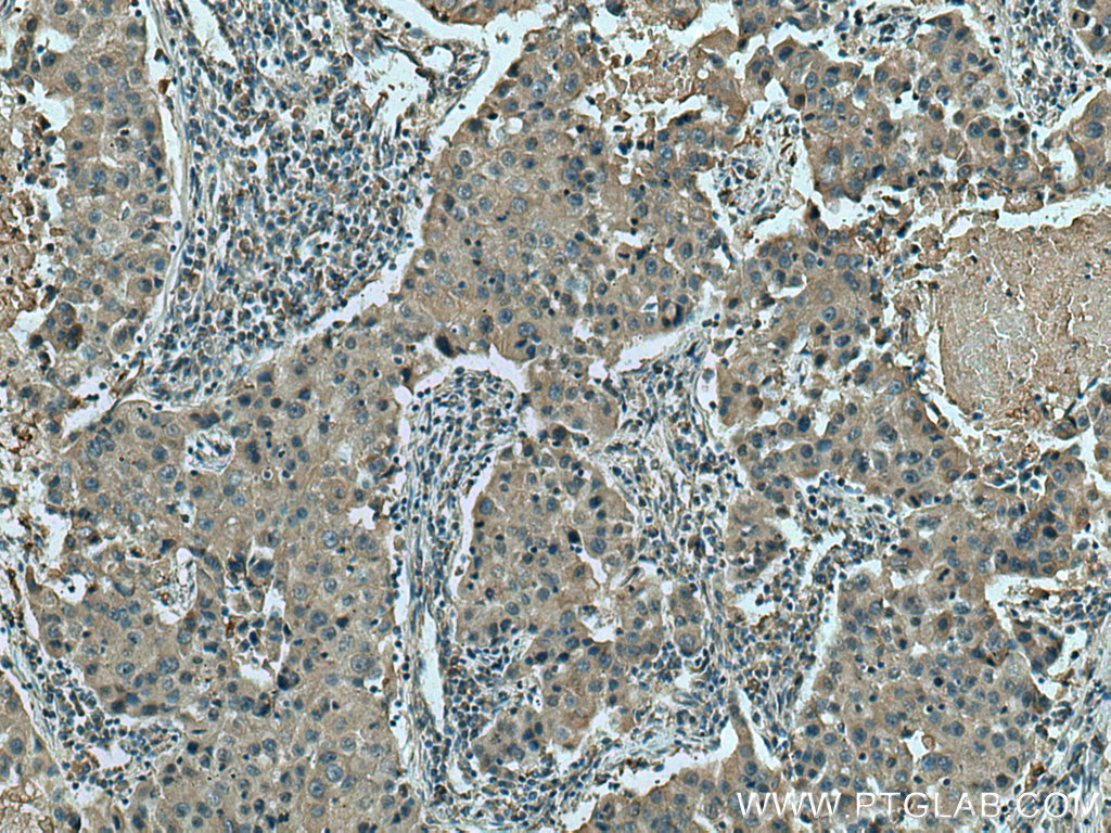 Hexokinase 2 Polyclonal antibody