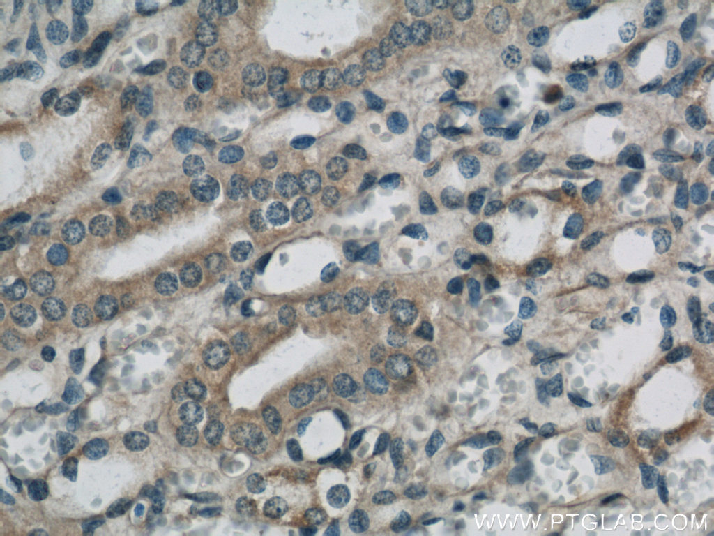 SARA Polyclonal antibody