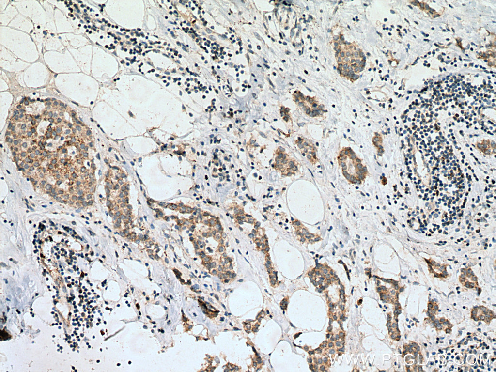 Bim Polyclonal antibody