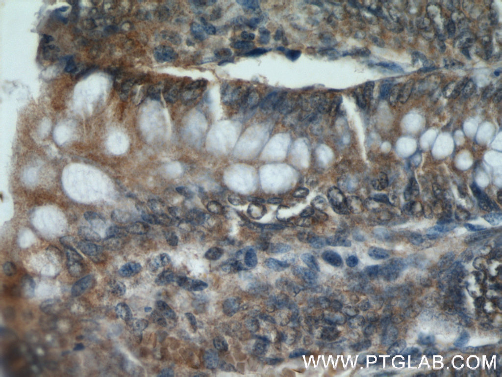 CCDC120 Polyclonal antibody