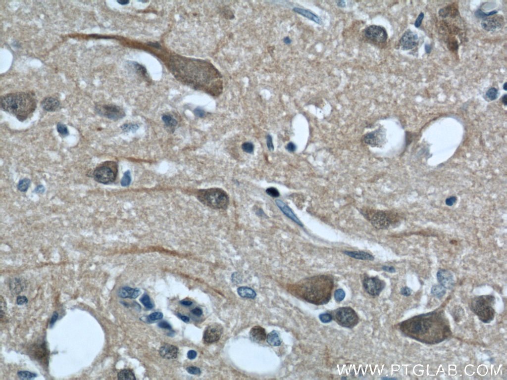 CALHM1 Polyclonal antibody