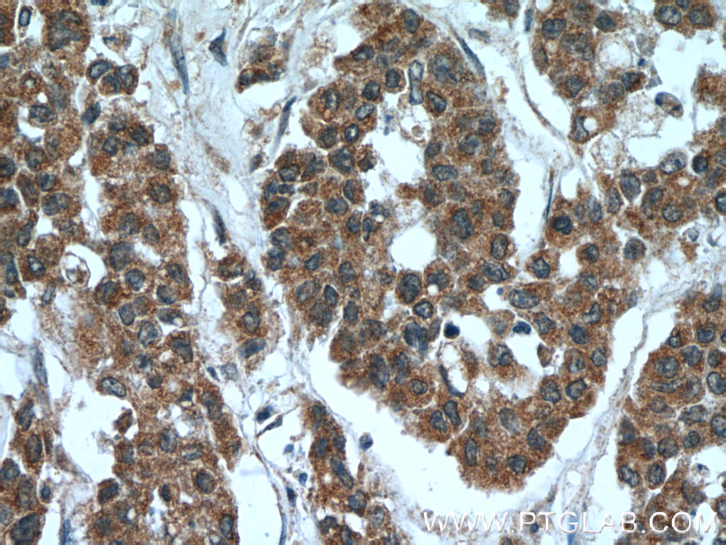 C5orf4 Polyclonal antibody