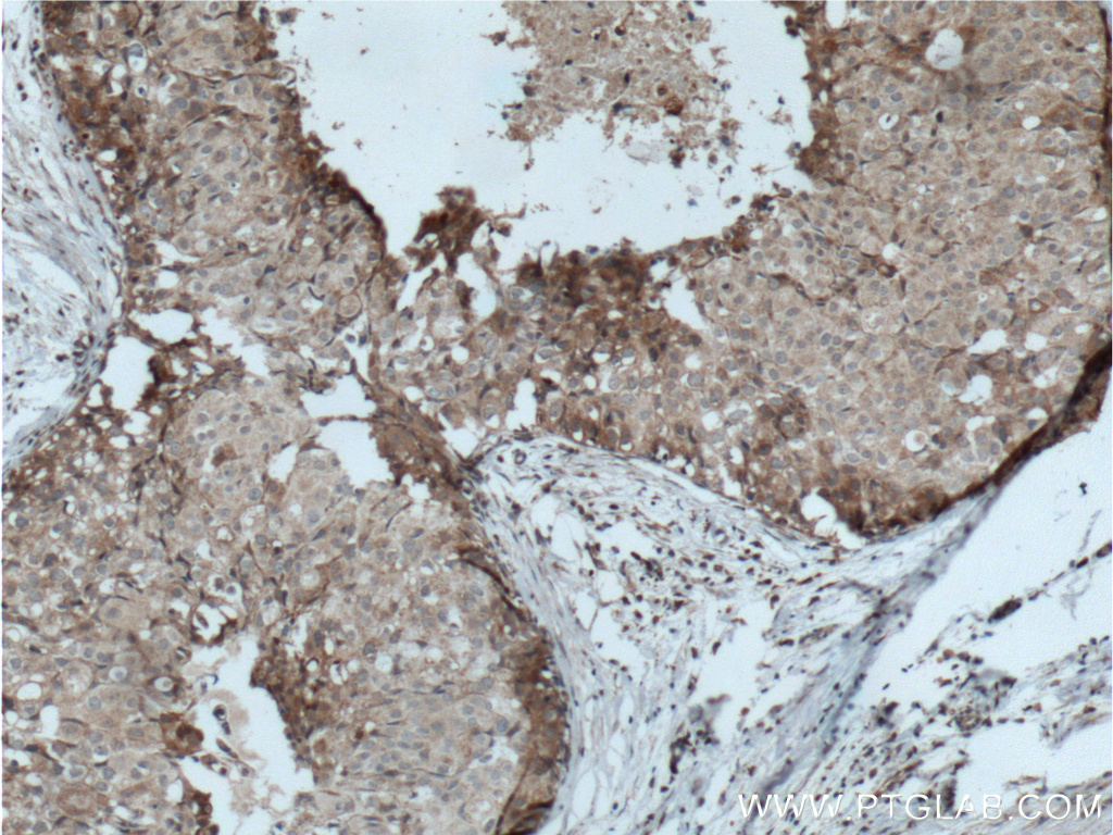 LTBP1 Polyclonal antibody