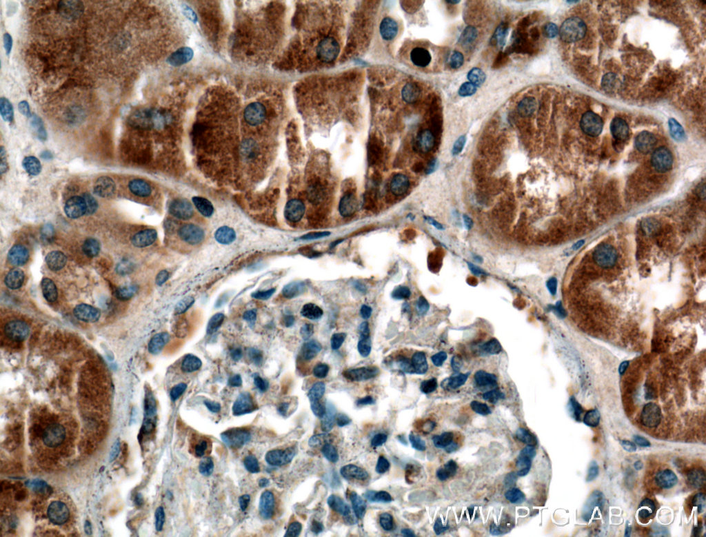 SYTL3 Polyclonal antibody