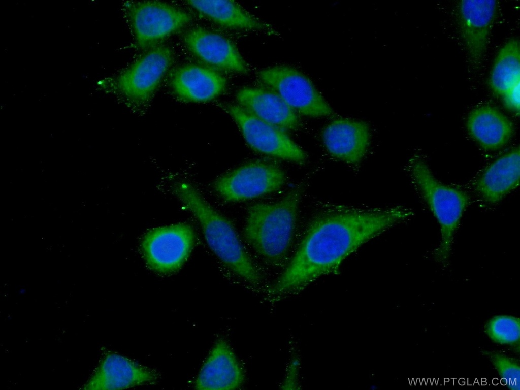ARHGAP27 Polyclonal antibody