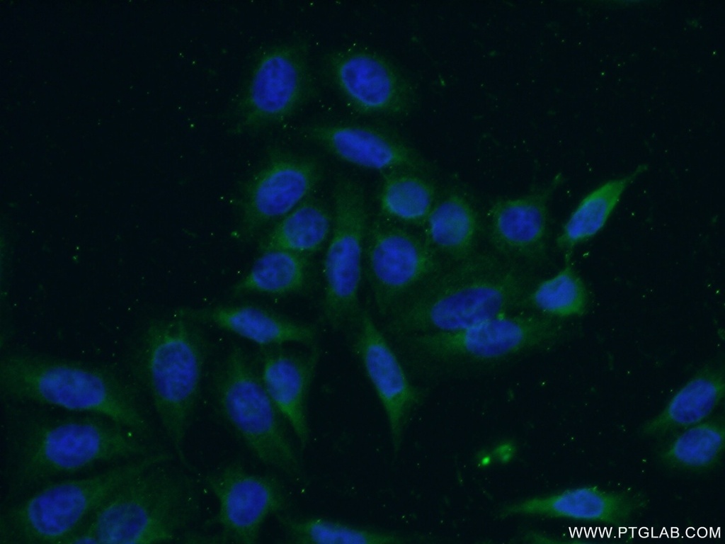 DULLARD Polyclonal antibody