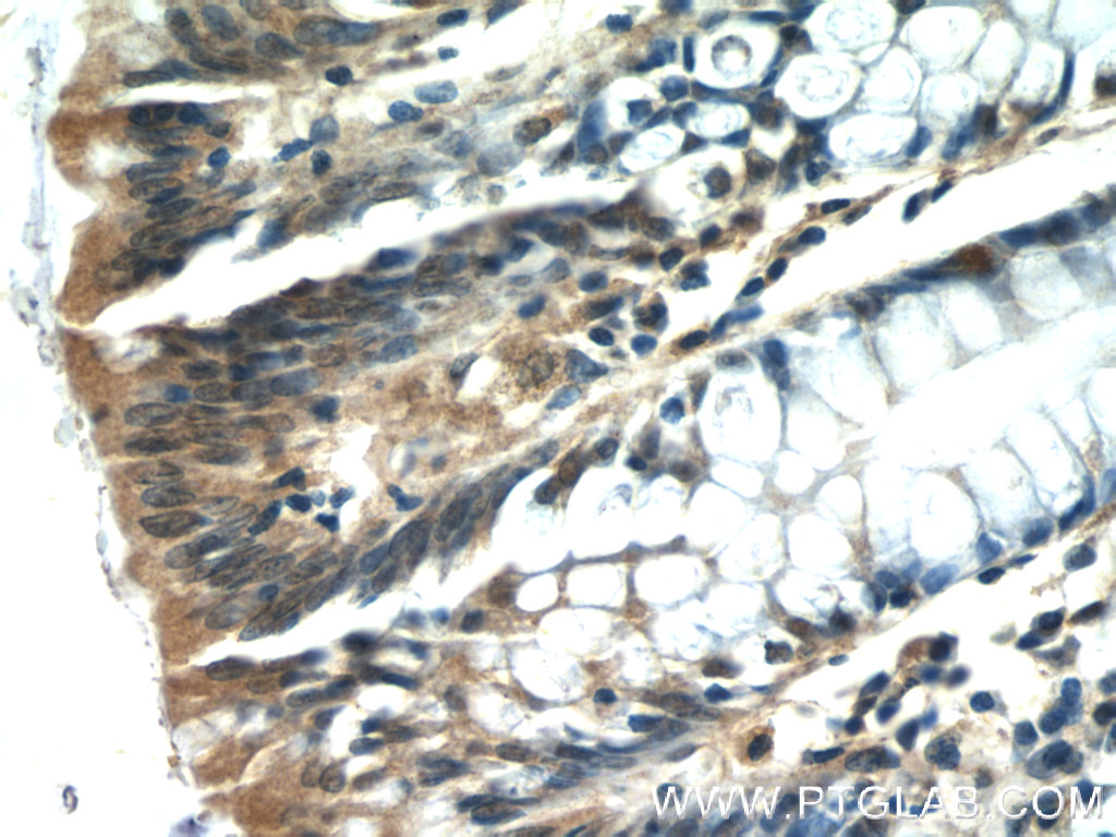 ISG20 Polyclonal antibody