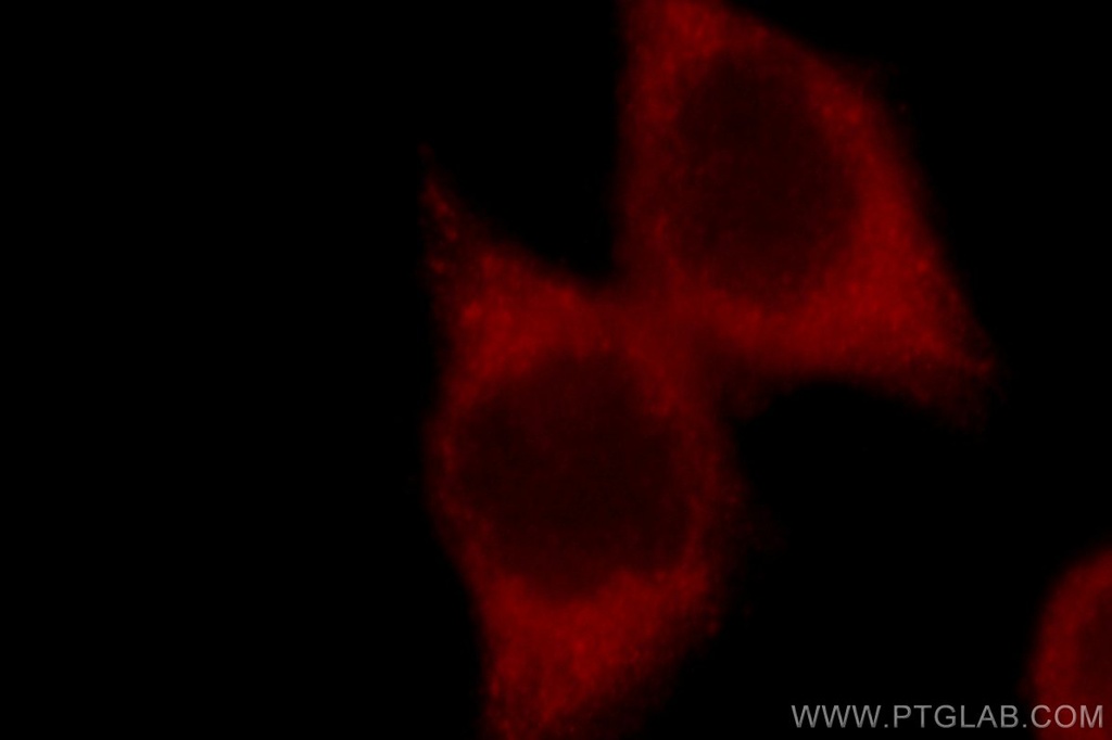 GSK3B Polyclonal antibody