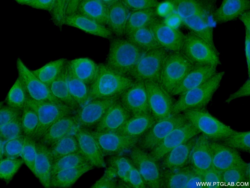 MYPT1 Polyclonal antibody