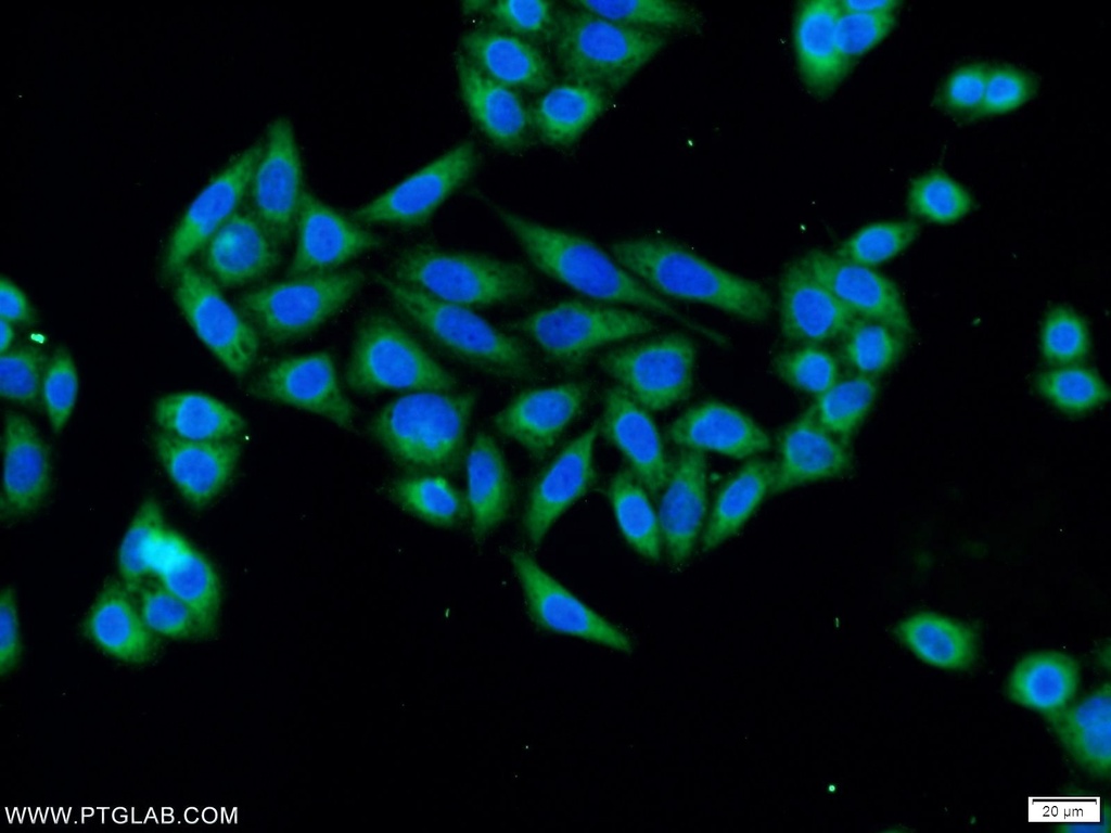 SLAIN1 Polyclonal antibody