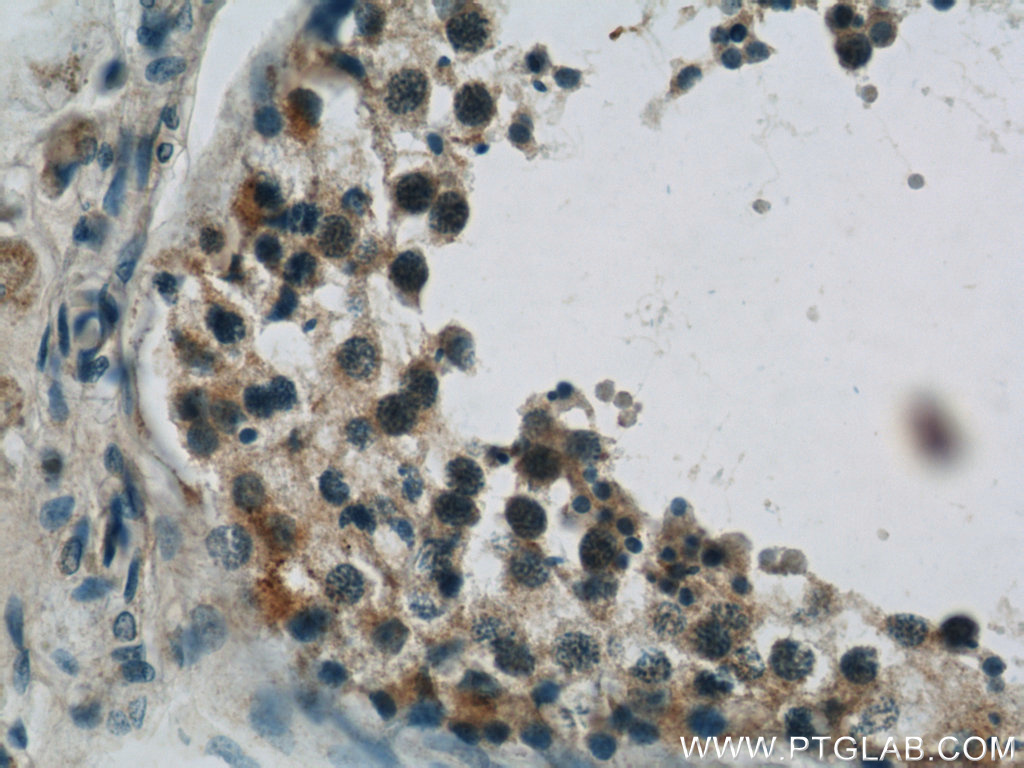 TBC1D1 Polyclonal antibody