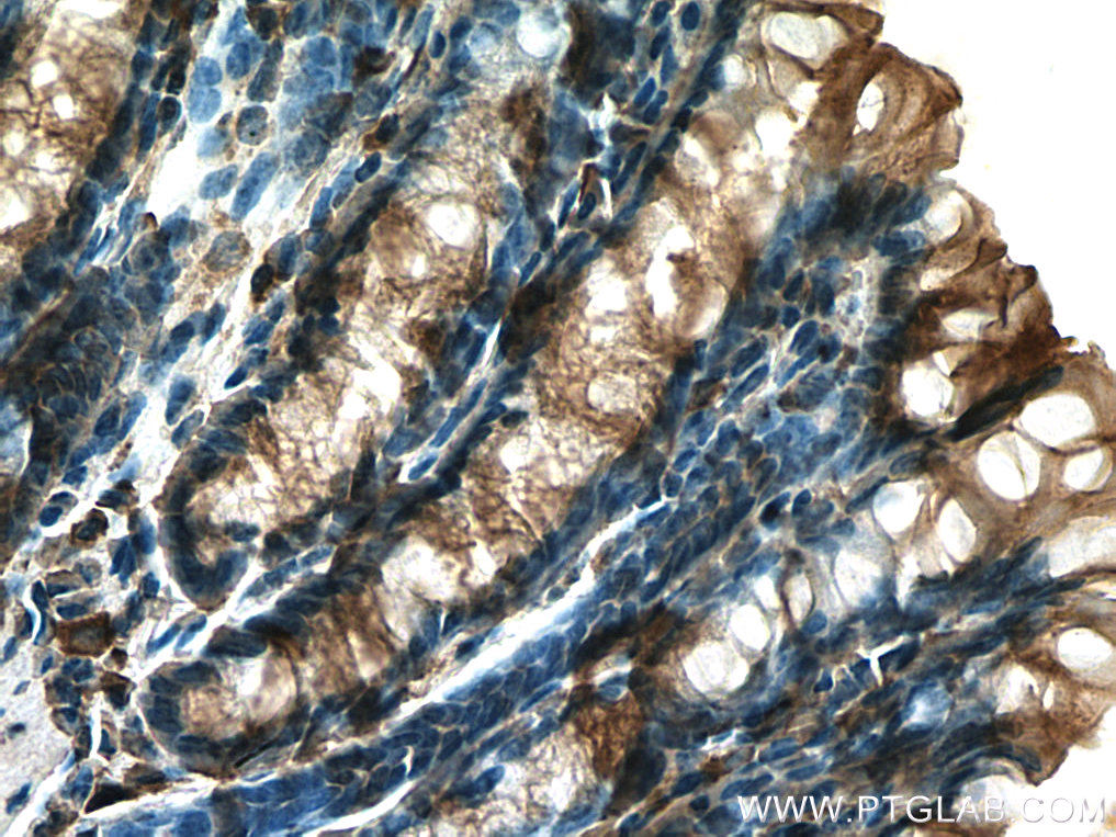 TIGAR Polyclonal antibody