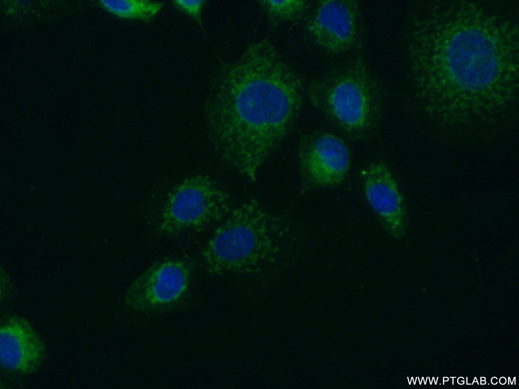 FUT4 Polyclonal antibody
