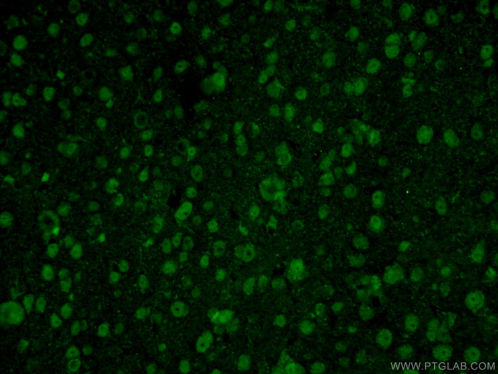 RCC1 Polyclonal antibody