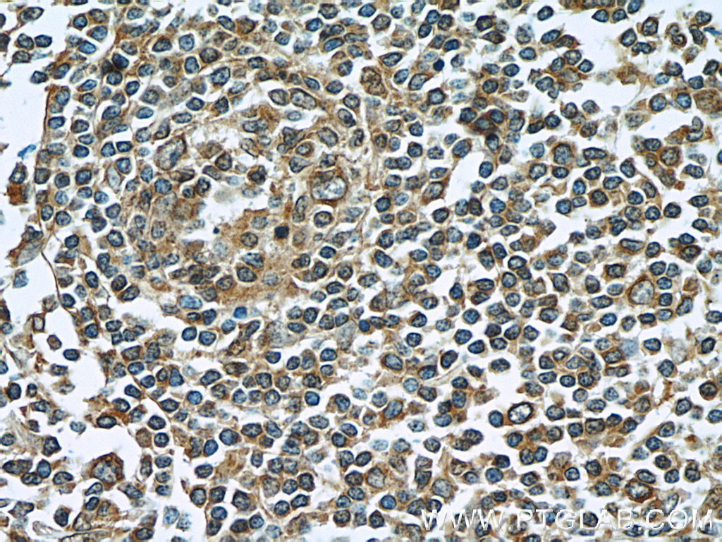 LY6E Polyclonal antibody