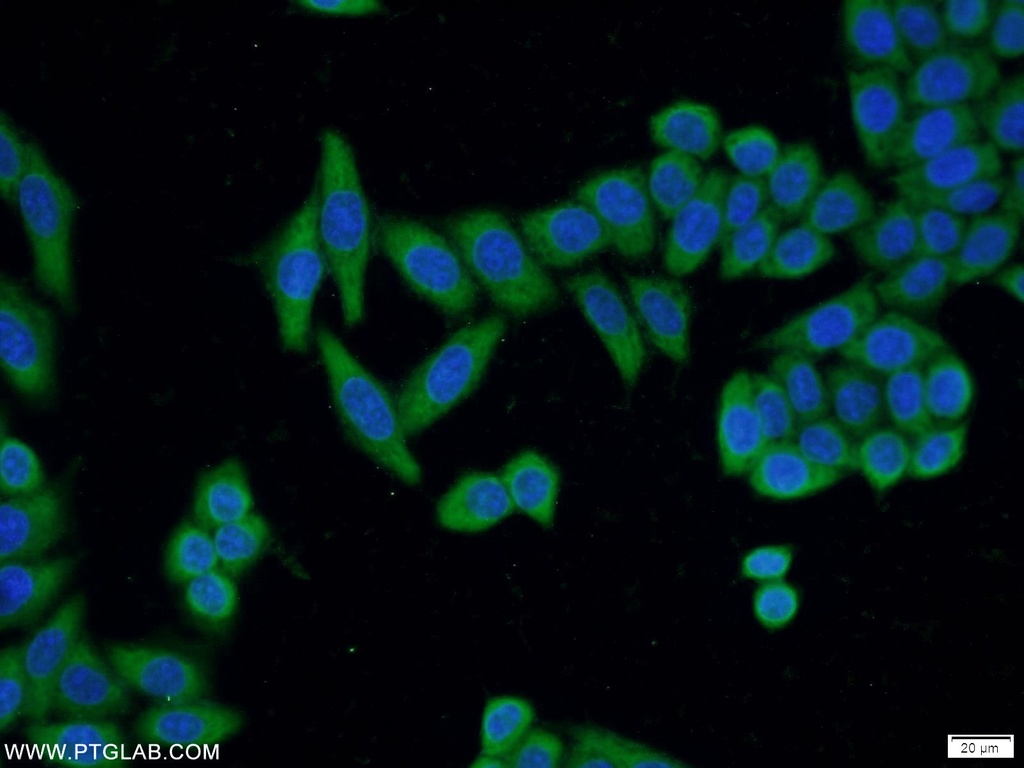 ADAM5 Polyclonal antibody