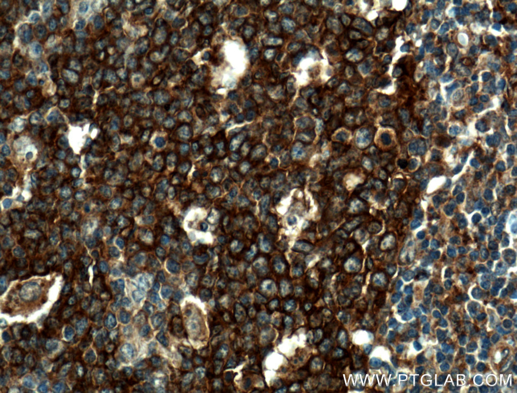 TRIM72 Polyclonal antibody