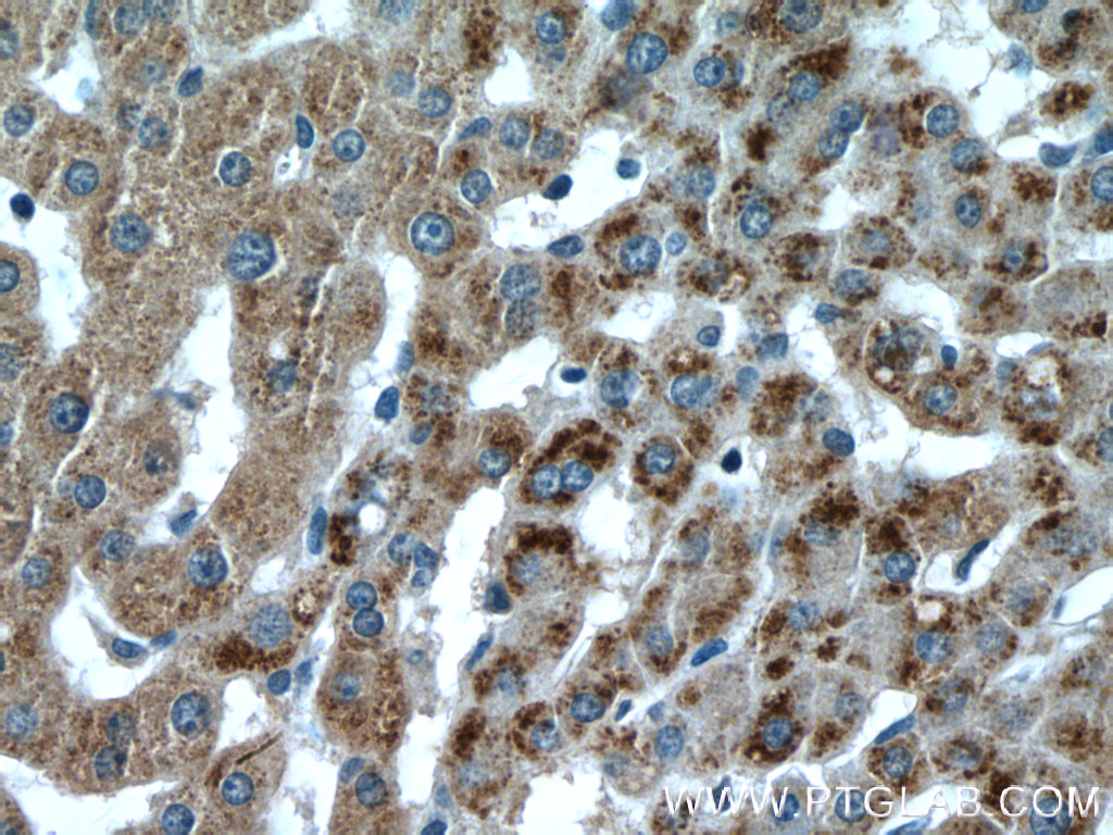 PXMP3 Polyclonal antibody