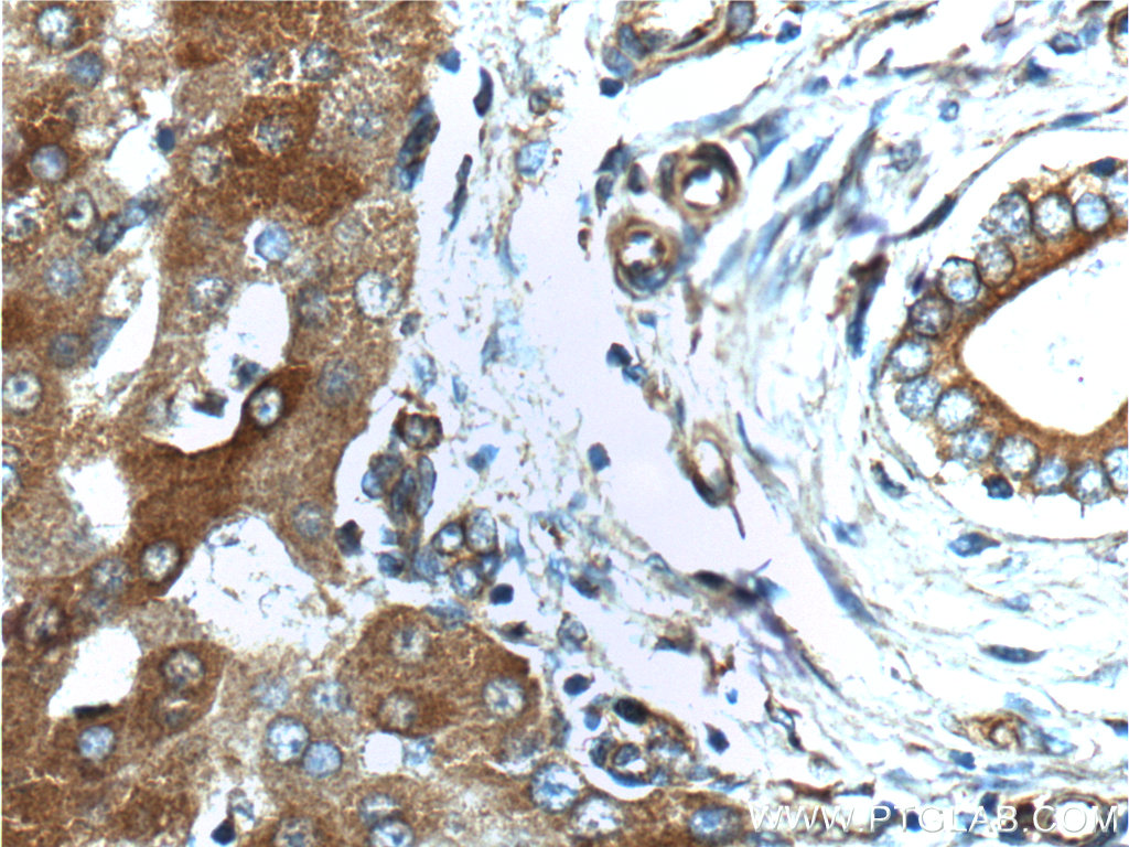 G6PC Polyclonal antibody