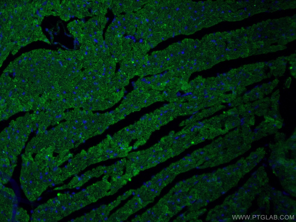 CPT1B-specific Polyclonal antibody