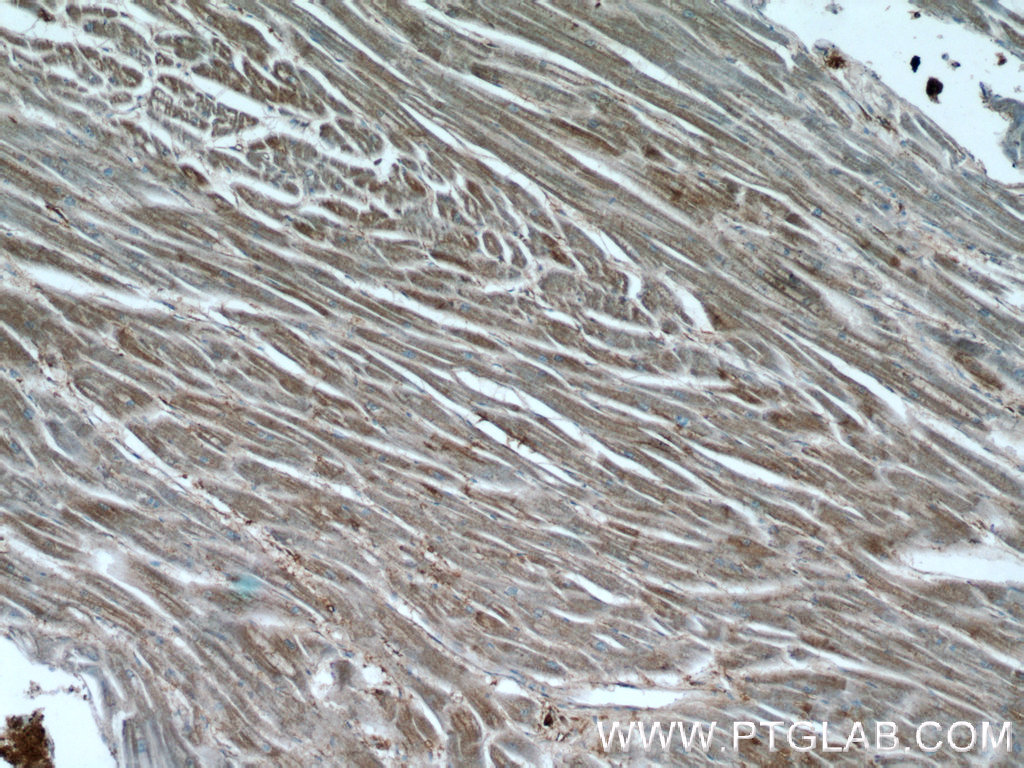 Desmin Polyclonal antibody