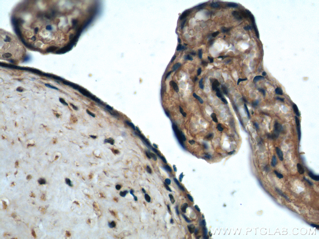 ADAM19 Polyclonal antibody