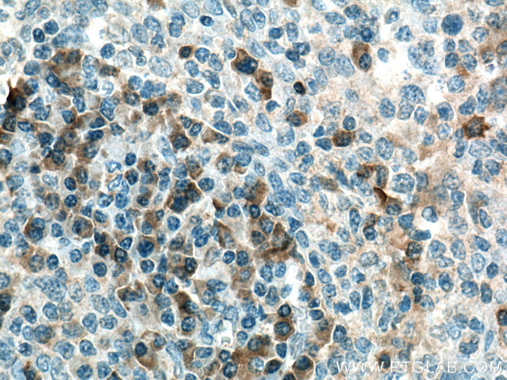 NOS2 Polyclonal antibody