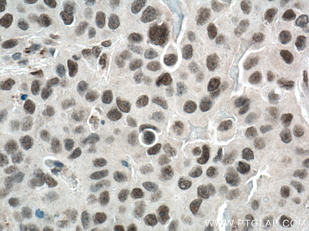 REST Polyclonal antibody